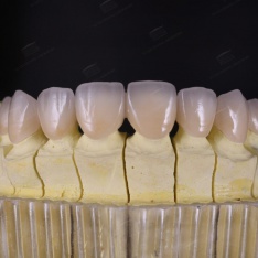 RĂNG SỨ CÁO CẤP VITA